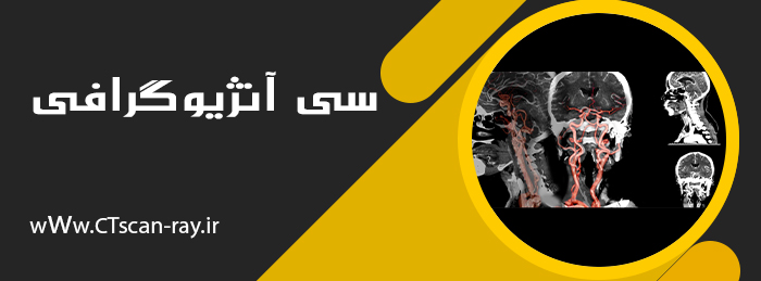 سی تی آنژیوگرافی | کاربرد‌ها و روش‌ اجرای آن